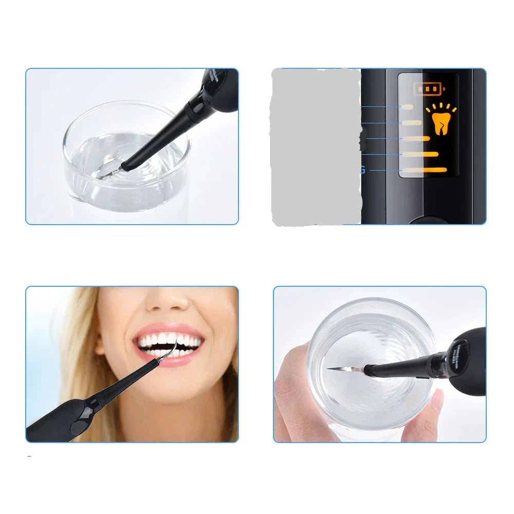 Wireless Waterproof Dental Scaler and Cleaner with LED Light