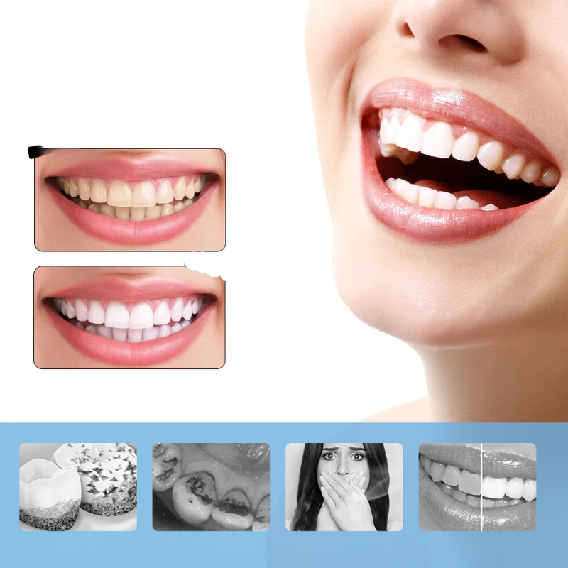 Six Speed Electric Teeth Whitening Scaler for Deep Cleaning