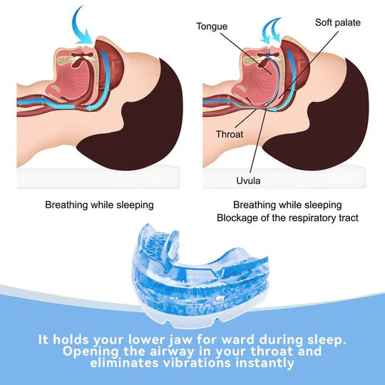 Adjustable Anti Snoring Mouth Guard for Better Sleep