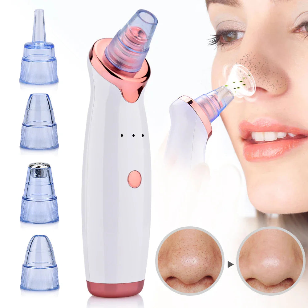 Blackhead and Acne Vacuum Tool for Deep Pore Cleansing
